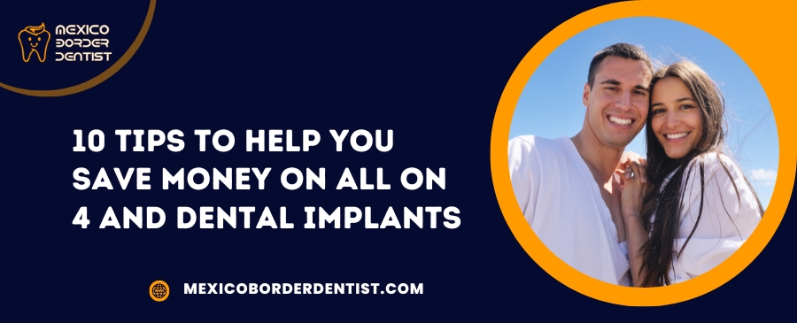10 Tips to Help You Save Money on All on 4 and Dental Implants