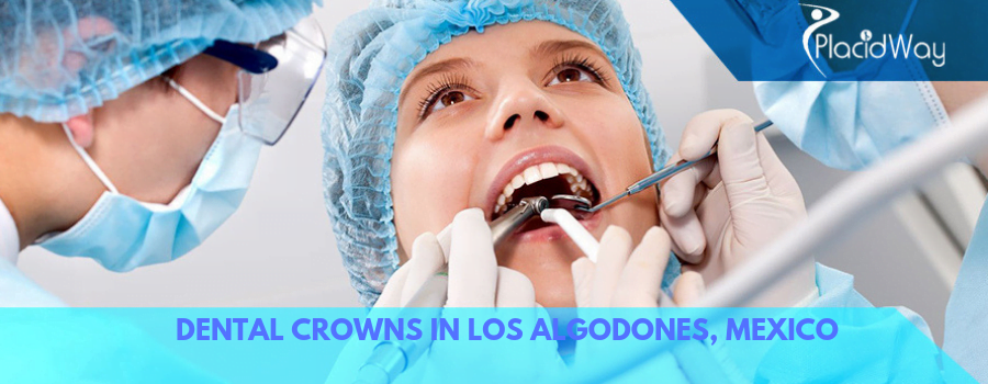 Dental Crown in Los Algodones Mexico