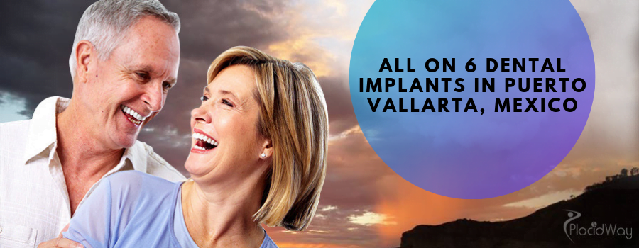 Dental Implants Puerto Vallarta