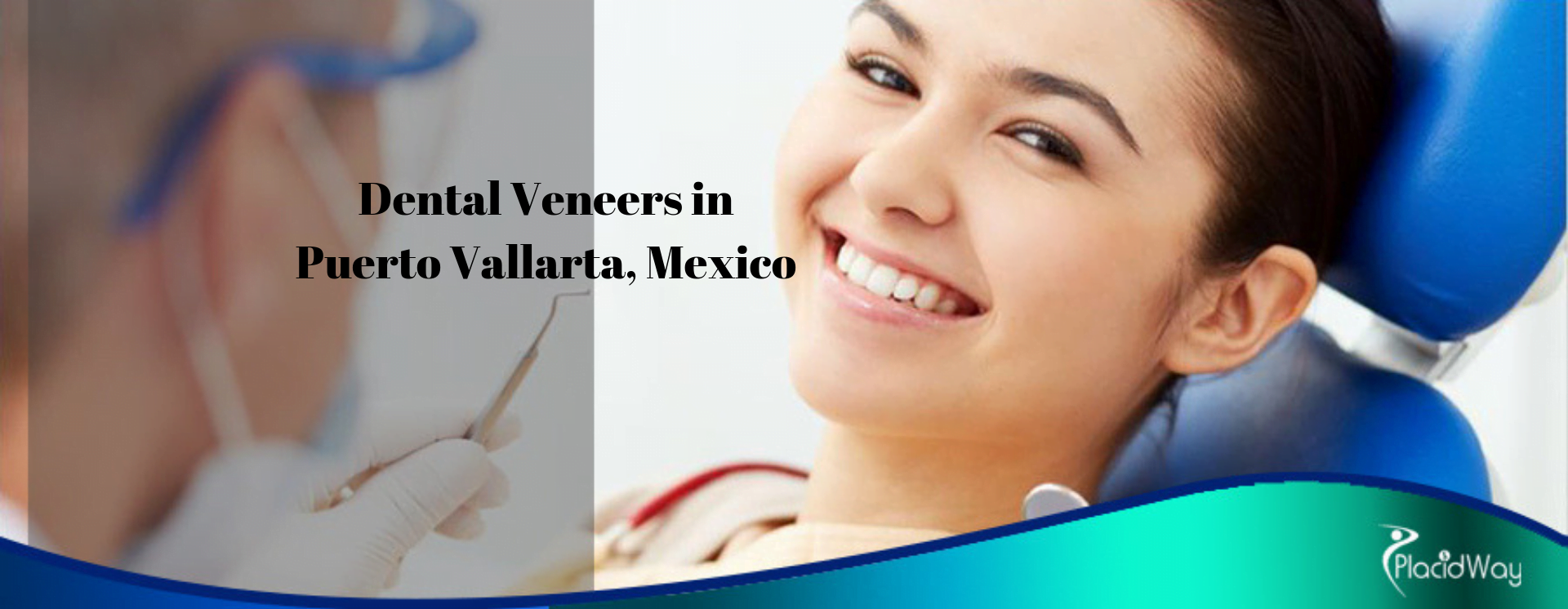 Dental-Veneers-in-Puerto-Vallarta-Mexico