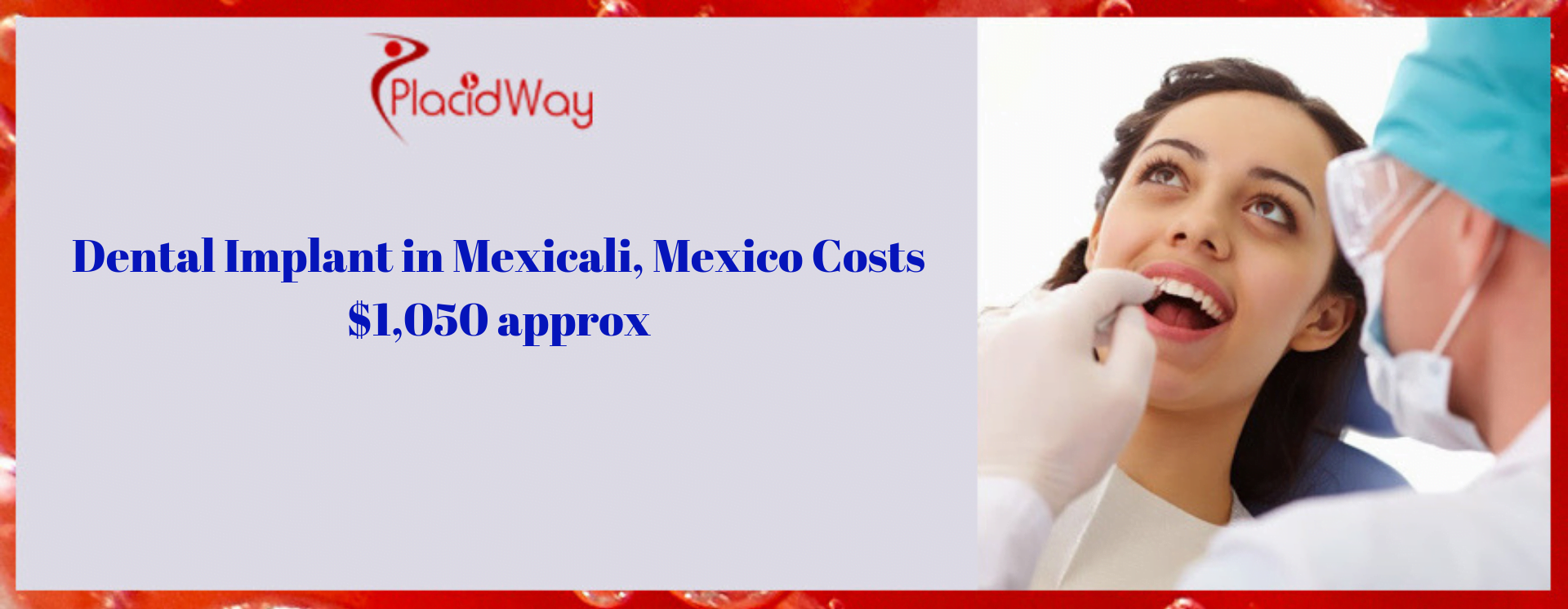 Dental Implants price Mexicali