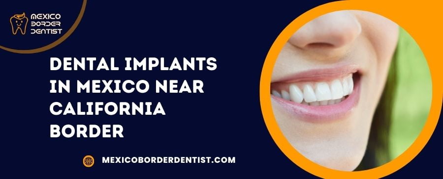 Dental Implants in Mexico Near California Border (1)