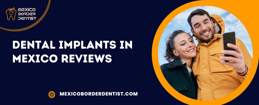 Dental Implants in Mexico Reviews