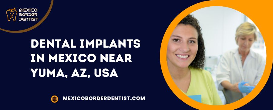 Dental Implants in Mexico Near Yuma, AZ