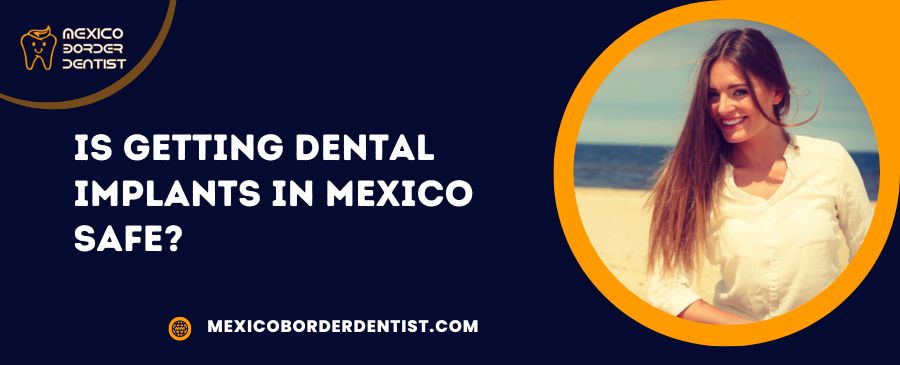 Is Getting Dental Implants in Mexico Safe