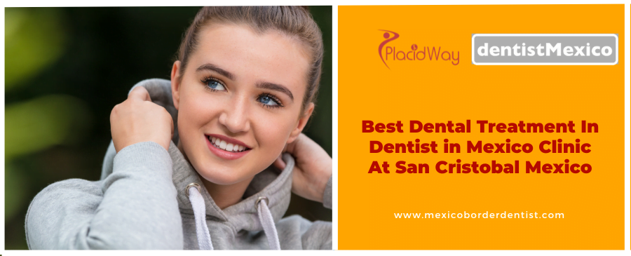 Best Dental Treatment In Dentist in Mexico Clinic At San Cristobal Mexico