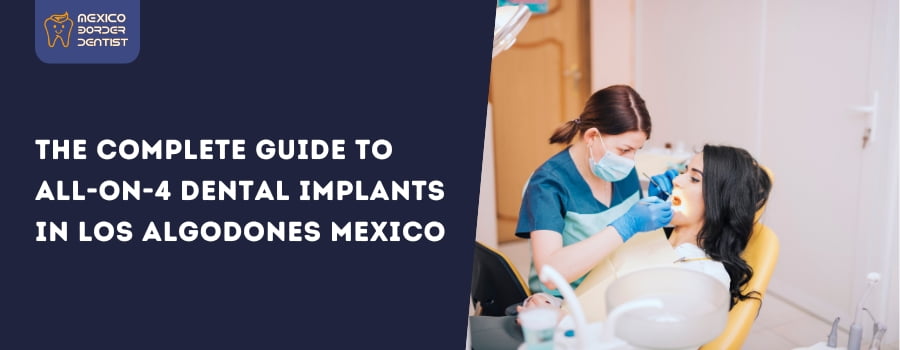 All-on-4 Dental Implants in Los Algodones Mexico
