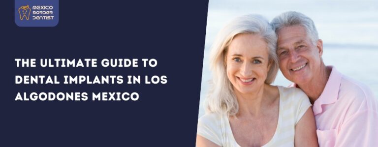 Complete Dental Implants Guide in Los Algodones Mexico