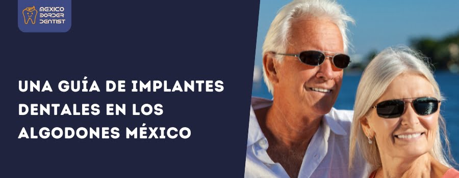 Una guía de implantes dentales en Los Algodones México