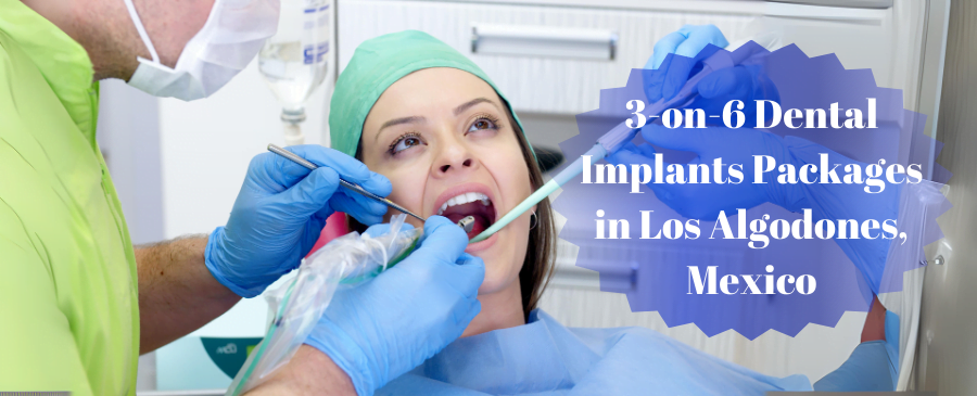 3-on-6 Dental Implants Packages in Los Algodones, Mexico