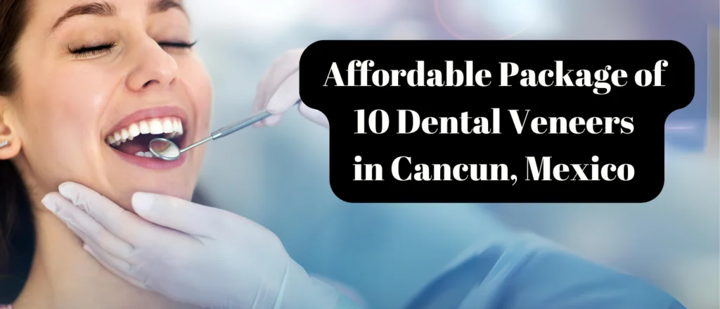 Affordable Package of 10 Dental Veneers in Cancun, Mexico