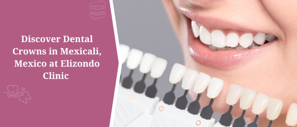 Discover Dental Crowns in Mexicali, Mexico at Elizondo Clinic