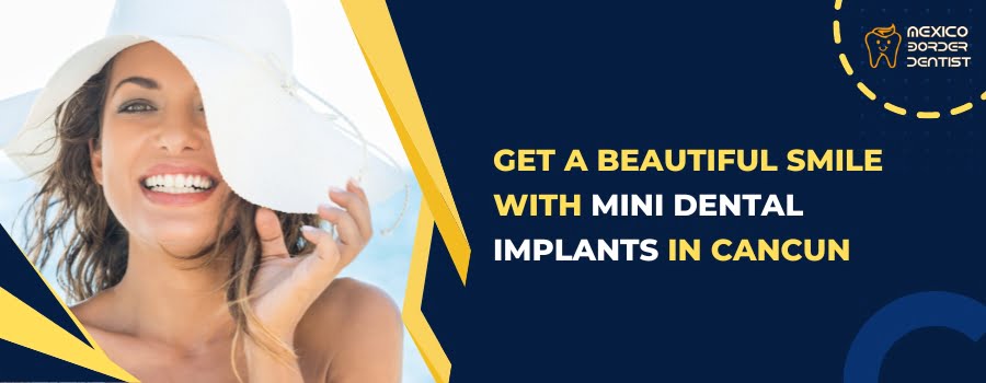 Get a Beautiful Smile with Mini Dental Implants in Cancun