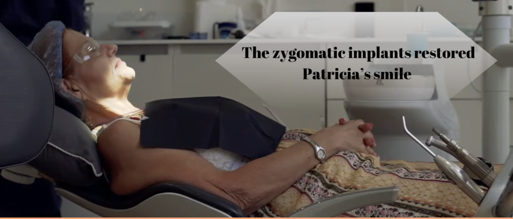 The zygomatic implants restored Patricia's smile