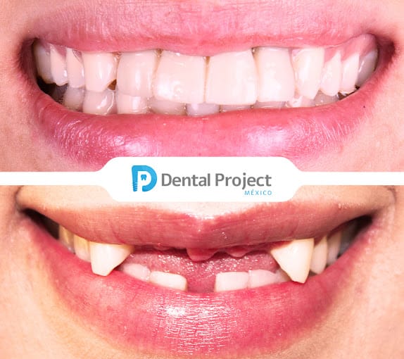 Dental Project Mexico