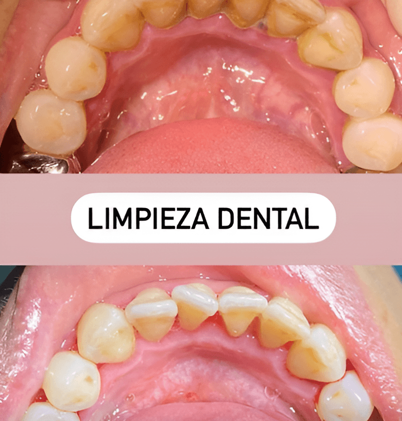 Fixing Smiles - Dental Clinic in Los Algodones, Mexico