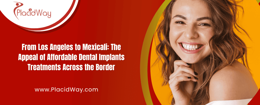 Budget-Friendly Dental Implants in Mexicali