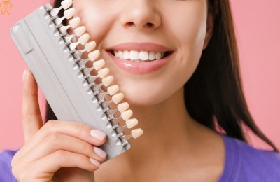 Dental Veneers in Mexico