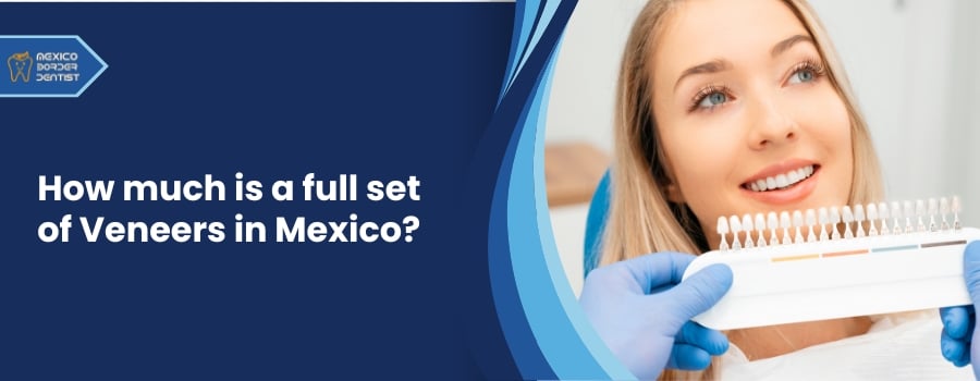 How much is a full set of Veneers in Mexico?