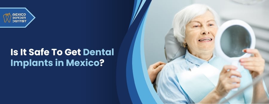 Is It Safe To Get Dental Implants in Mexico?