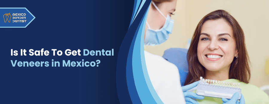 Is It Safe To Get Dental Veneers in Mexico