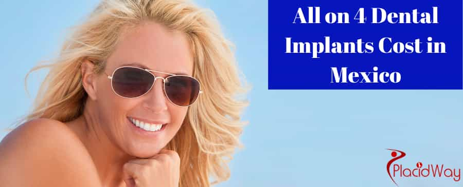 Get Affordable All-on-4 Dental Implants in Mexico