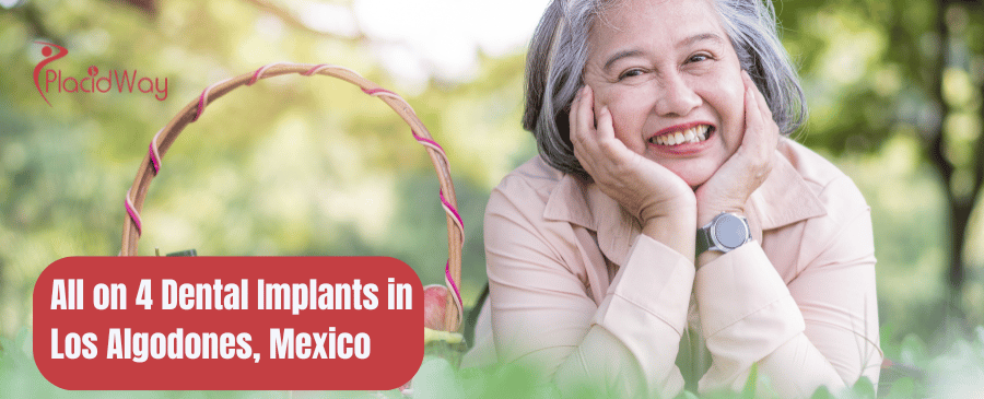 A guide to All-on-4 Dental Implants in Los Algodones Mexico