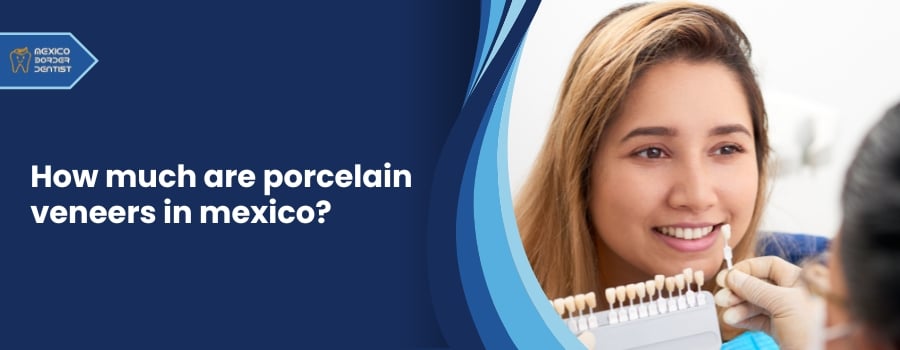 How much are porcelain veneers in mexico