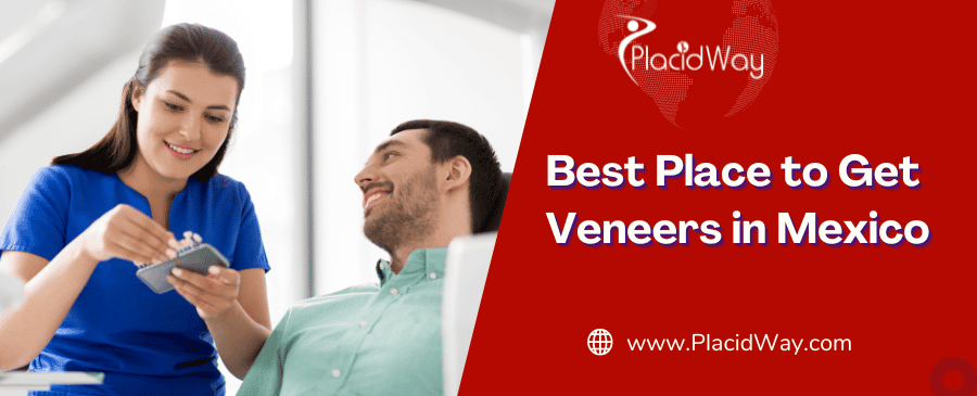 Top 5 Destinations for Affordable Veneers in Mexico