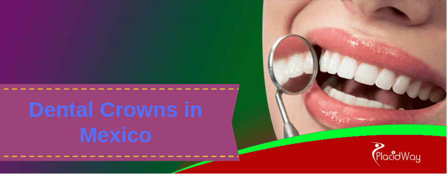 Dental Crowns in Mexico