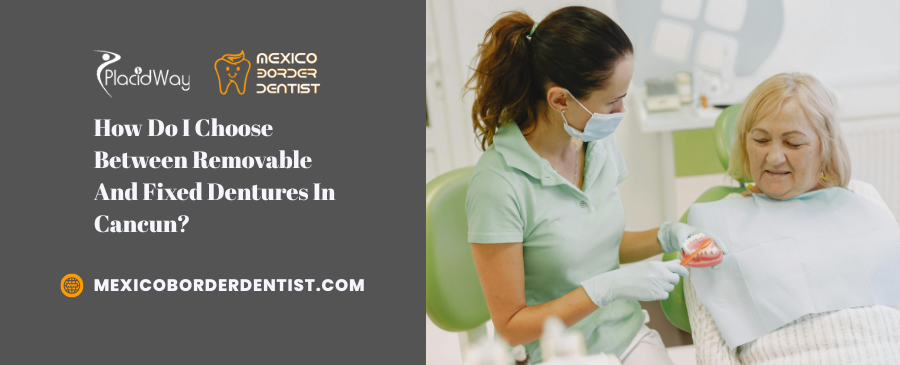 How Do I Choose Between Removable And Fixed Dentures In Cancun