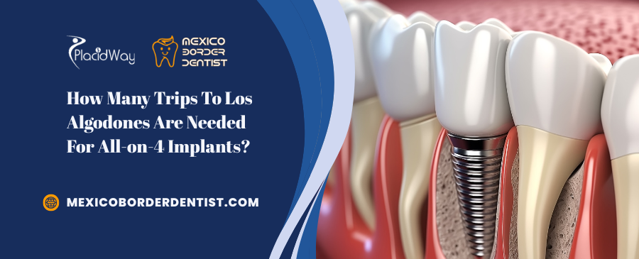 How Many Trips To Los Algodones Are Needed For All on 4 Implants