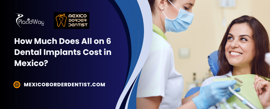 How Much Does All On 8 Dental Implants Cost In Mexico 1