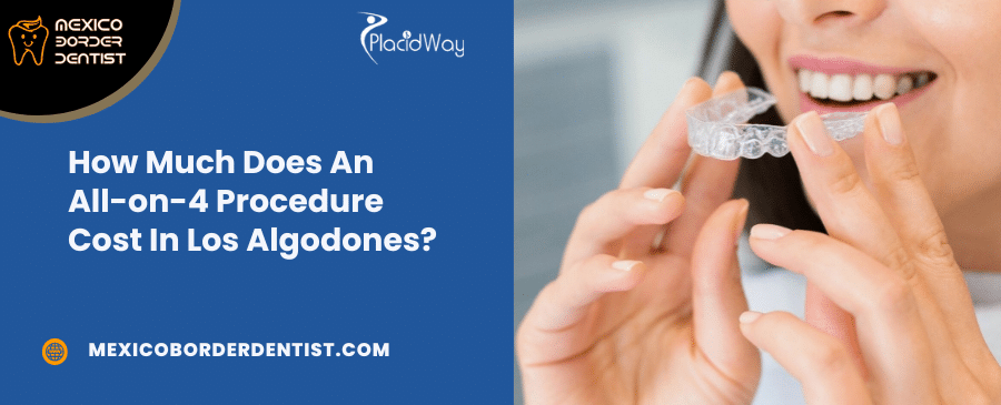 How Much Does An All on 4 Procedure Cost In Los Algodones How Much Does An All-on-4 Procedure Cost In Los Algodones