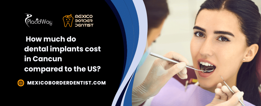How much do dental implants cost in Cancun compared to the US