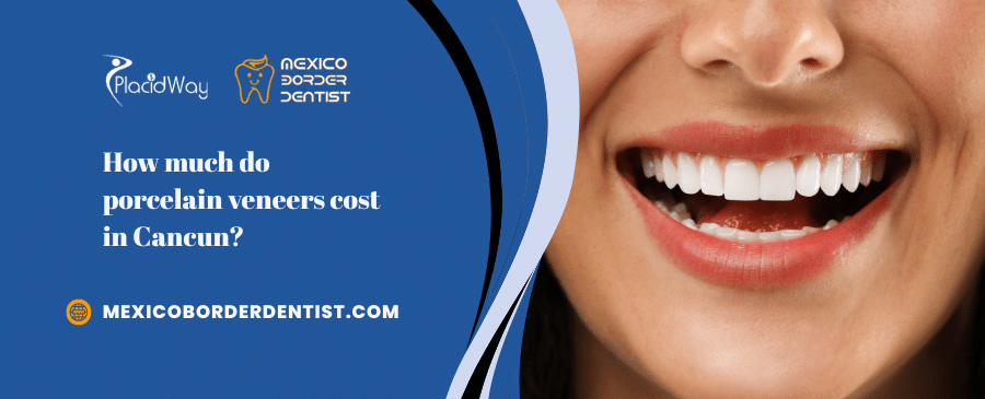 How much do porcelain veneers cost in Cancun
