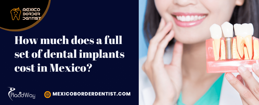 How much does a full set of dental implants cost in