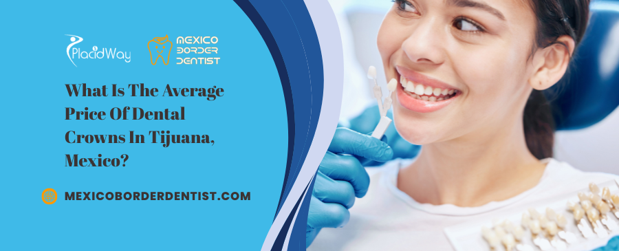 What Is The Average Price Of Dental Crowns In Tijuana What Is The Average Price Of Dental Crowns In Tijuana
