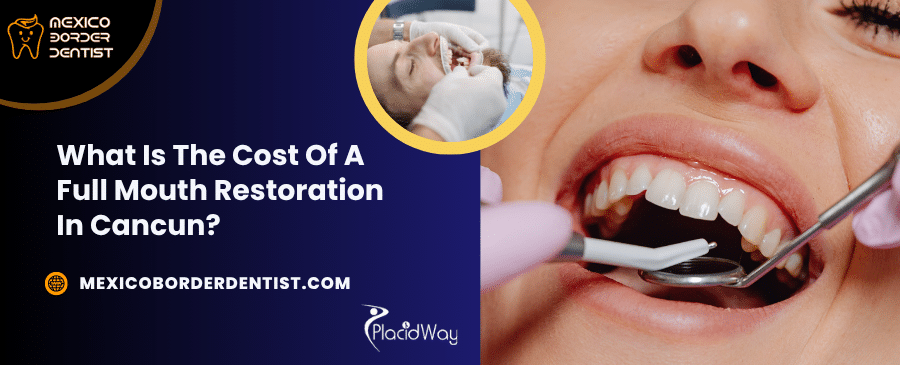 What Is The Cost Of A Full Mouth Restoration In Cancun 1