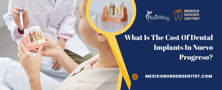 What Is The Cost Of Dental Implants In Nuevo Progreso What Is The Cost Of Dental Implants In Nuevo Progreso