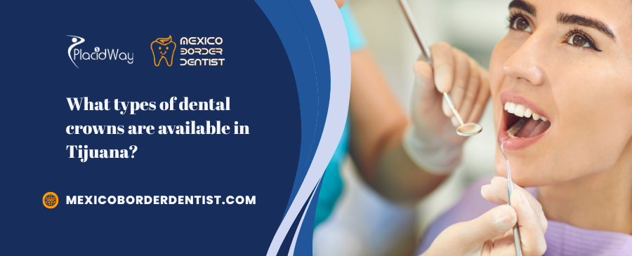 What types of dental crowns are available in Tijuana What types of dental crowns are available in Tijuana