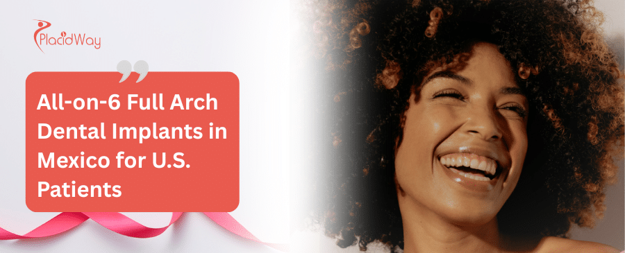 All-on-6 Full Arch Dental Implants in Mexico for U.S. Patients