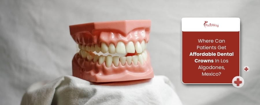1758710382 2 Where Can Patients Get Affordable Dental Crowns In Los Algodones, Mexico?