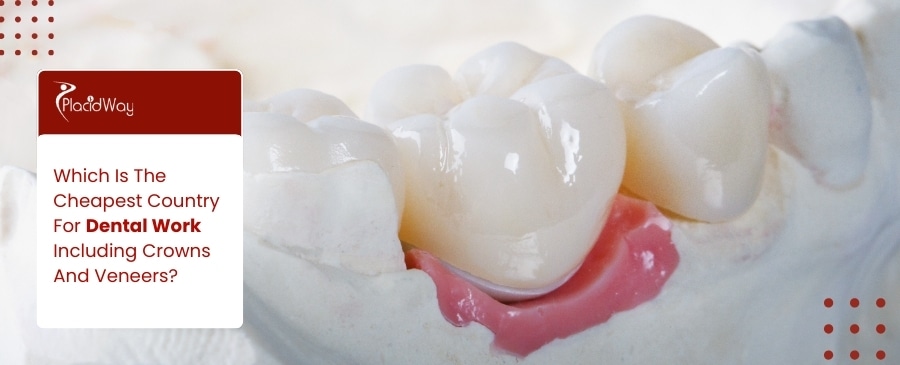 1758712400 3 Which Is The Cheapest Country For Dental Work Including Crowns And Veneers?