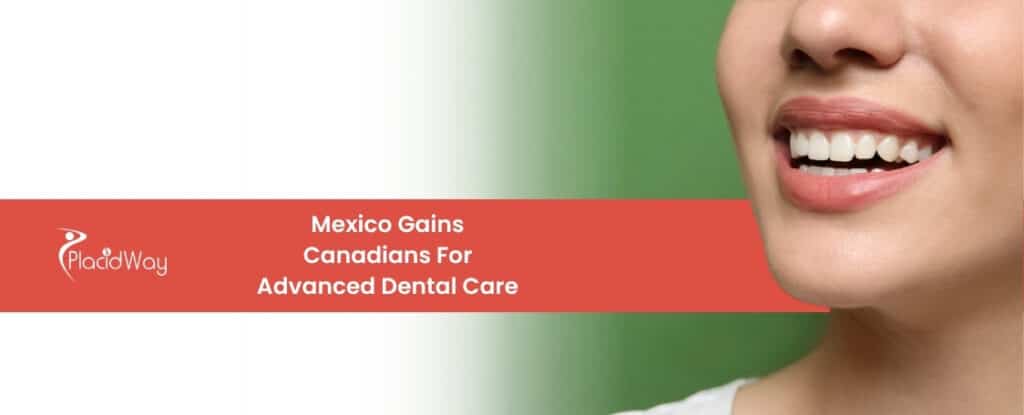 1776238344 Canadians Trade Winter for New Teeth All on 4 Dental Tourism Booms in Cancun Mexico 2 Winter Traded for New Teeth: The Massive Boom of All-on-4 Dental Tourism in Cancun, Mexico