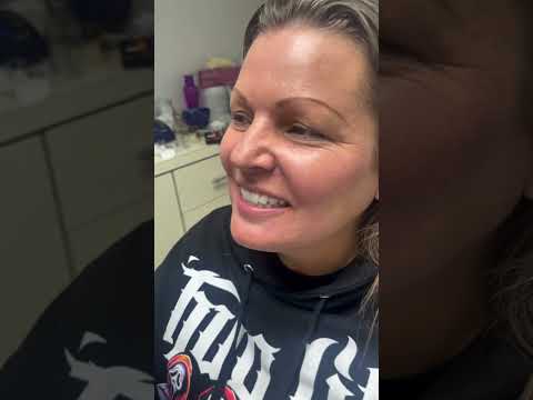 Full Mouth Smile Makeovers in Los Algodones, Mexico – Professional Care, Phonetics, and Stunning Results