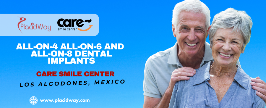 Are All-on-4 Dental Implants in Los Algodones, MX Right for You?