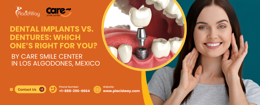 Should You Choose Dental Implants or Affordable Dentures in Los Algodones, Mexico?