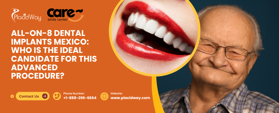 Who Is the Ideal Candidate for All-on-8 Dental Implants in Mexico?