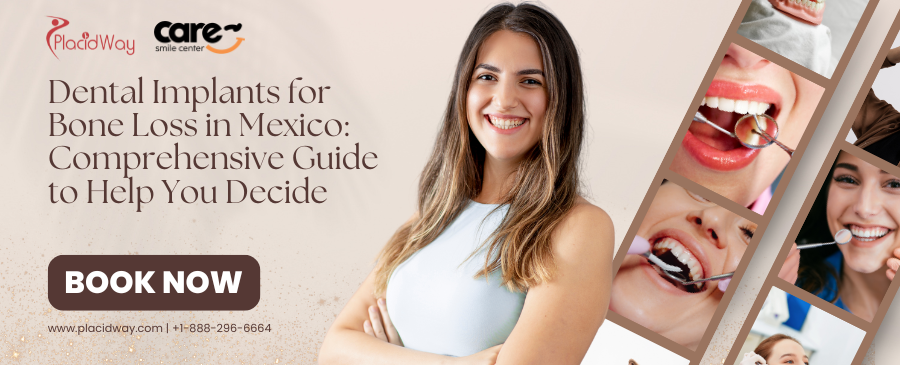Can I Get Dental Implants if I Have Bone Loss in Mexico?